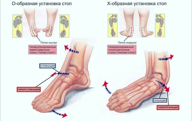 Воспаление надкостницы: как лечить и как не получить