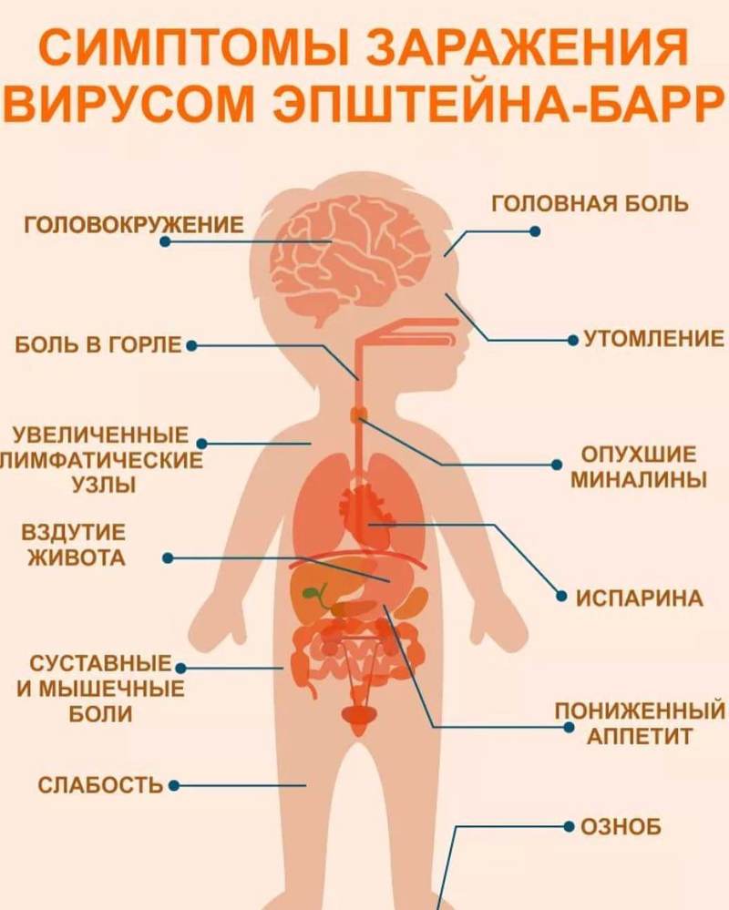 Инфекционный мононуклеоз: Главные признаки заболевания