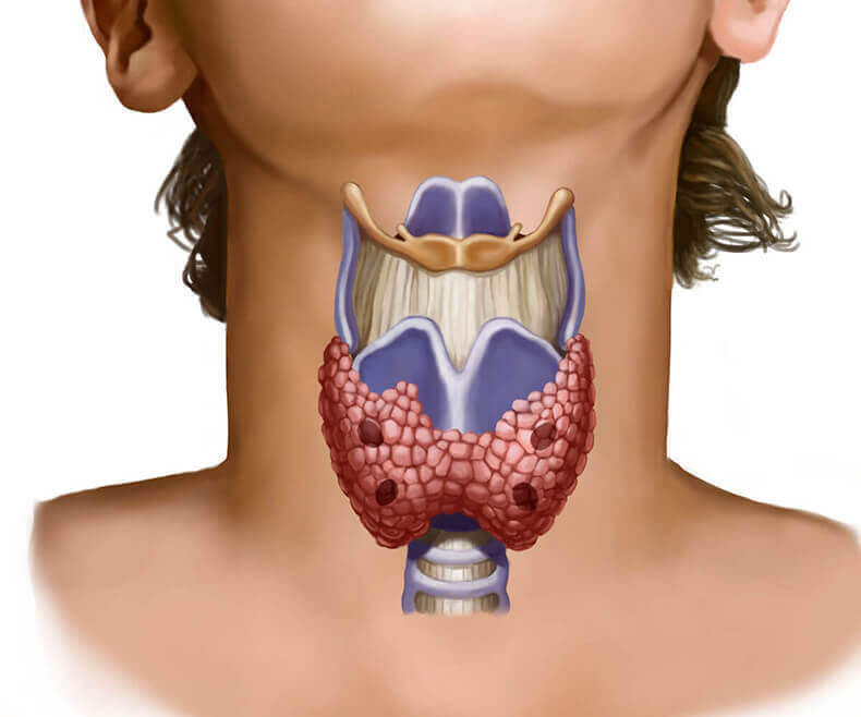 ПОЧЕМУ БОЛЕЕТ ЩИТОВИДНАЯ ЖЕЛЕЗА