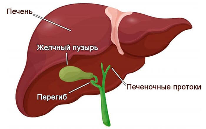 Желчный пузырь: Симптомы перегиба 