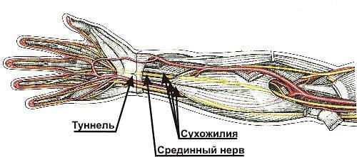 Туннельные синдромы: Что ВАЖНО знать всем, кто работает за компьютером 