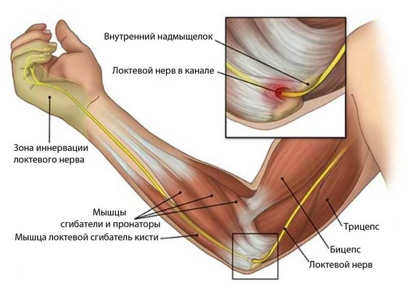 Туннельные синдромы: Что ВАЖНО знать всем, кто работает за компьютером 