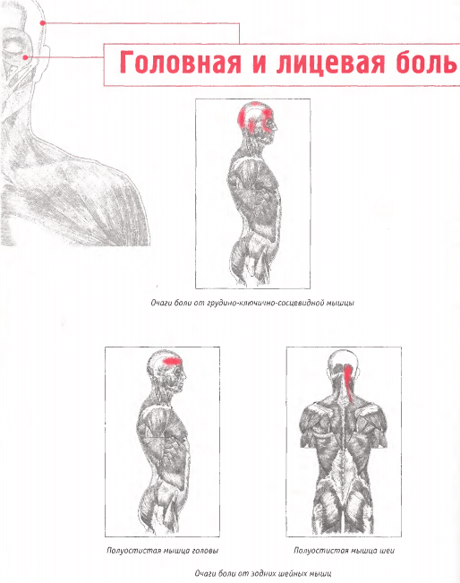 Головная и лицевая боль: Триггерные точки