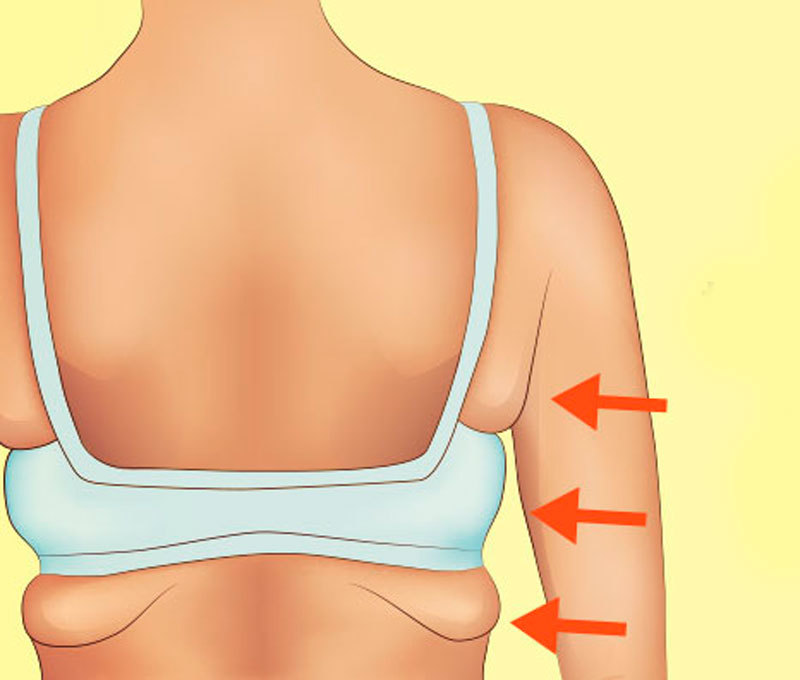 Как убрать жир с подмышек? 5 упражнений и другие методы 