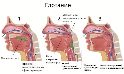 Первая помощь если что-то застряло в горле — прием Геймлиха 