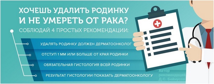 Опасные родинки: 3 правила для предупреждения меланомы