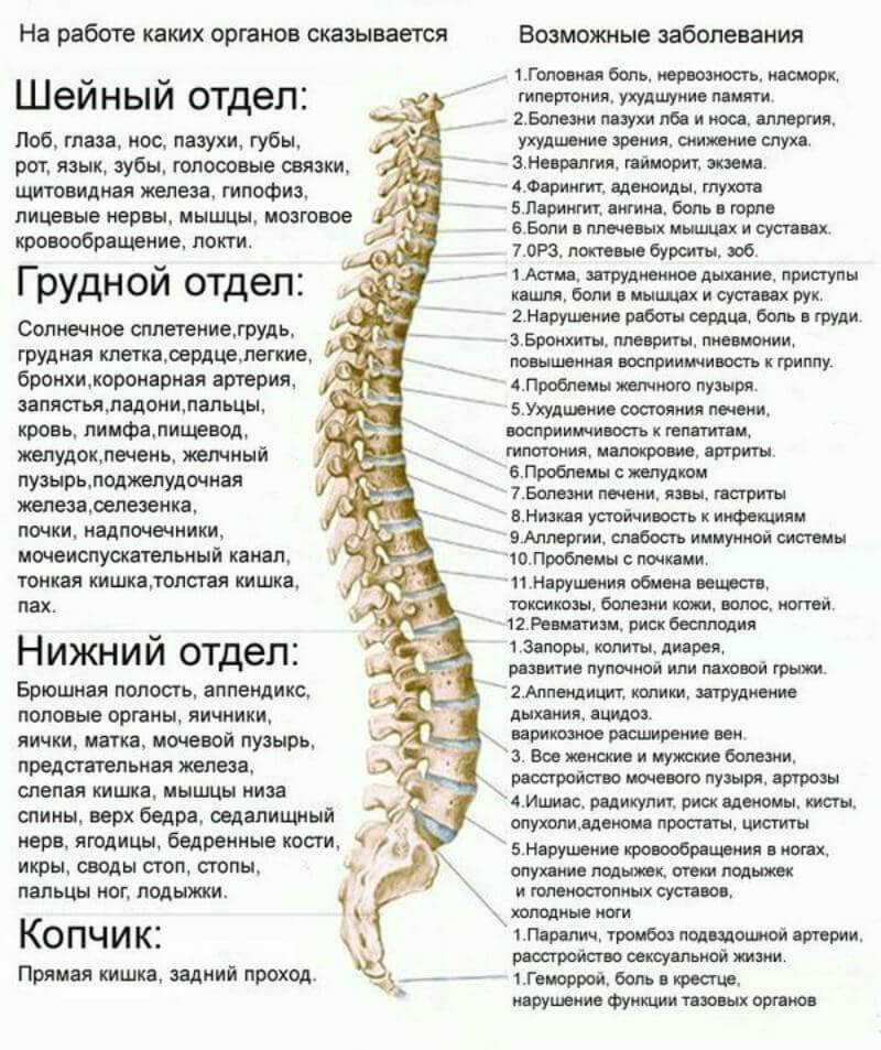 Корешковый синдром: Что такое «радикулит» и от чего он появляется?