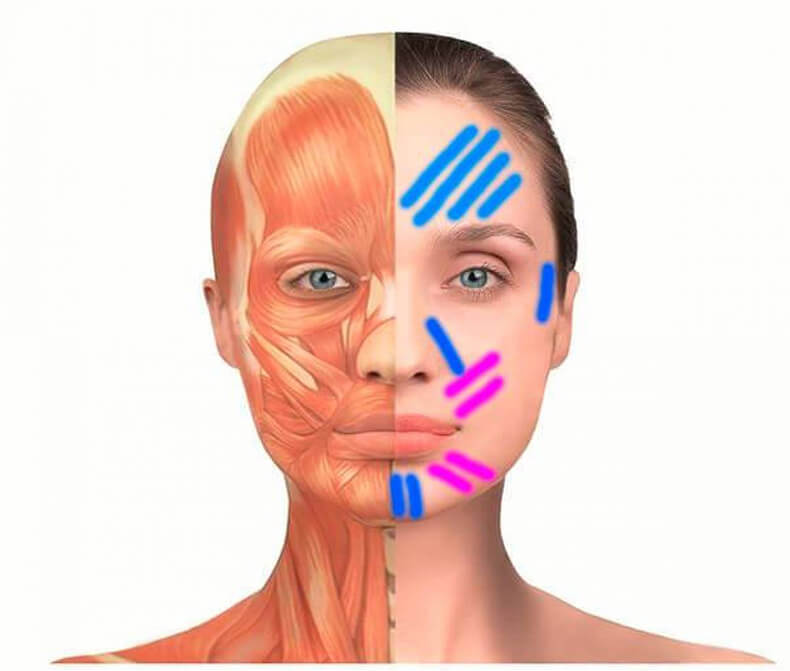 Избавляемся от морщин! Схемы и советы по кинезиологическому тейпированию лица 