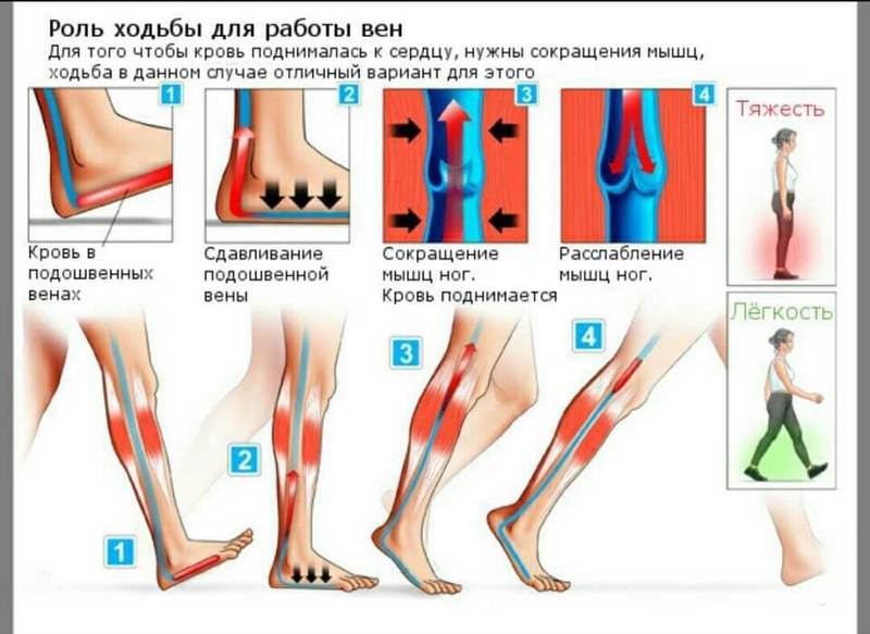 Варикозное расширение вен: Полезный комплекс  упражнений