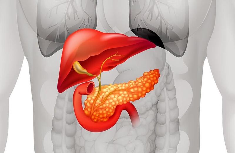 Рак поджелудочной железы: 10 ранних симптомов, которые нельзя игнорировать