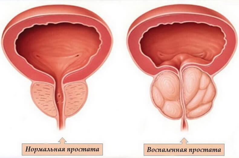 Основные признаки урологических заболеваний