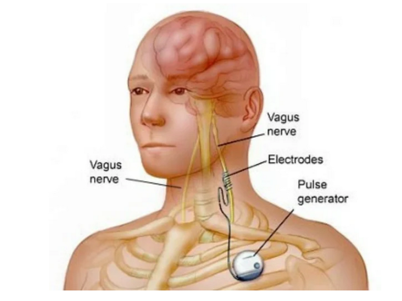 Как остановить старение при помощи простой стимуляции блуждающего нерва