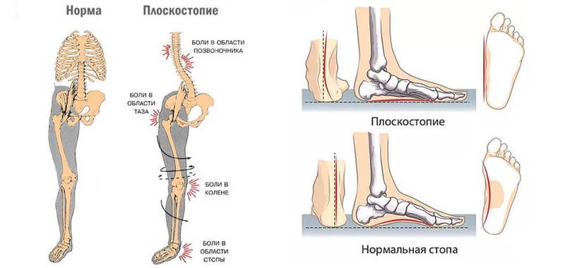 Всем, кто не хочет стать обузой для близких - СОХРАНИТЕ СЕБЕ!