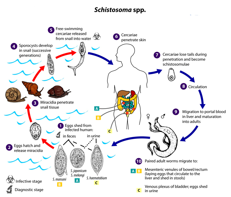 Шистосомоз: Признаки паразитарного заболевания
