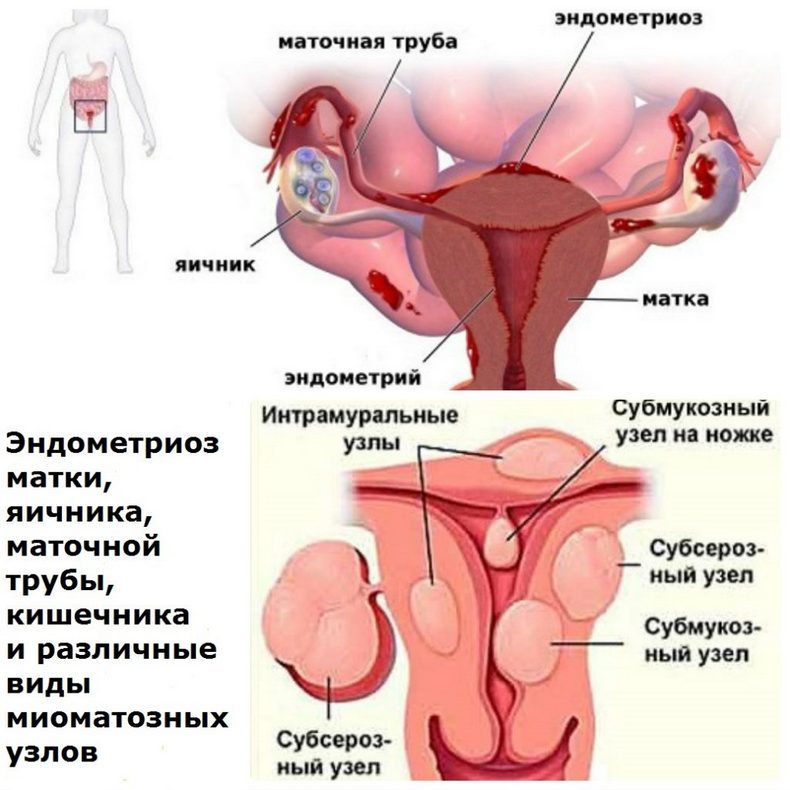 Индол 3 карбинол: Средство, тормозящее механизм старения