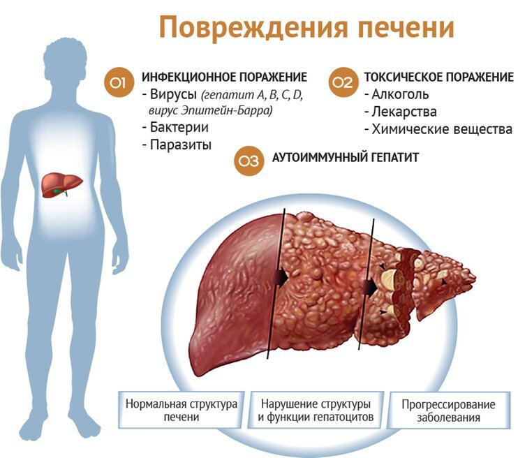 Проверьте печень: экспресс-тест на обнаружение проблем