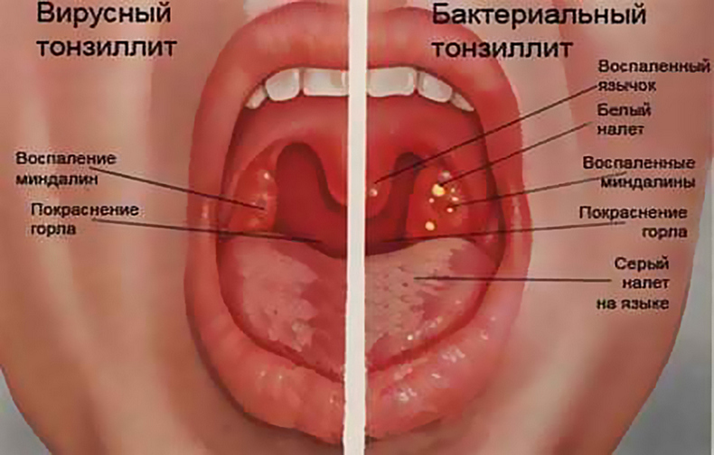 Поза льва: Незаменимое упражнение для здоровья 