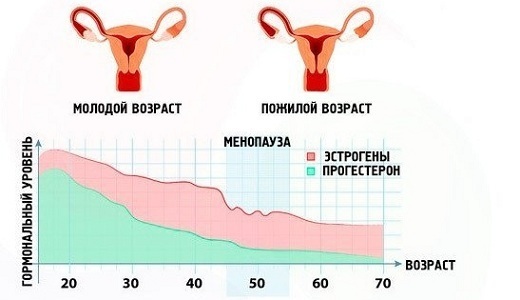 Менопауза: что нужно знать каждой женщине