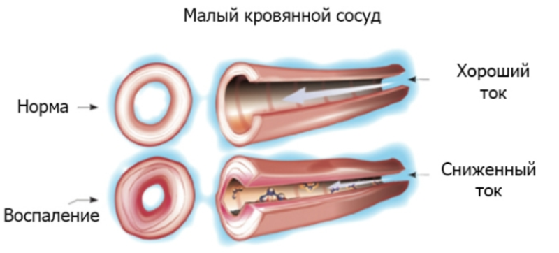 Что скрывается за постоянной усталостью