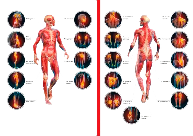 Триггерные точки на вашем теле запускают боль и патологии