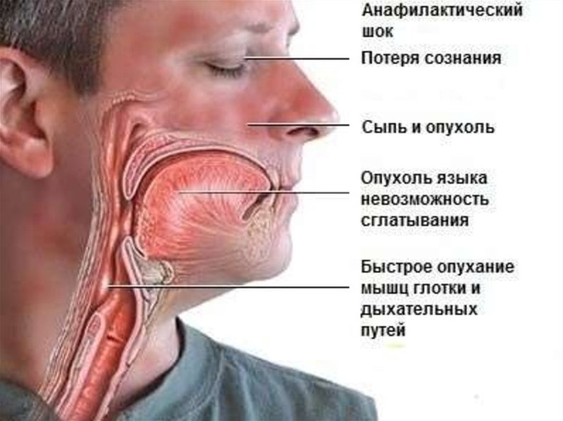 Если отеки не проходят, копайте глубже: психосоматика застоя лимфы