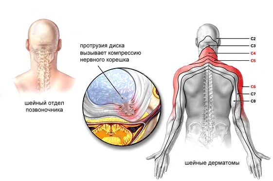 Почему немеют руки: 7 возможных заболеваний