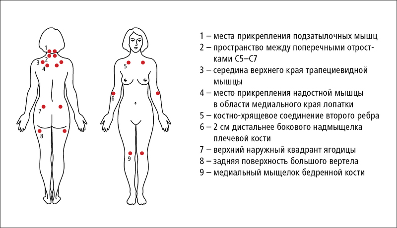 Фибромиалгия: когда боль и усталость не проходят