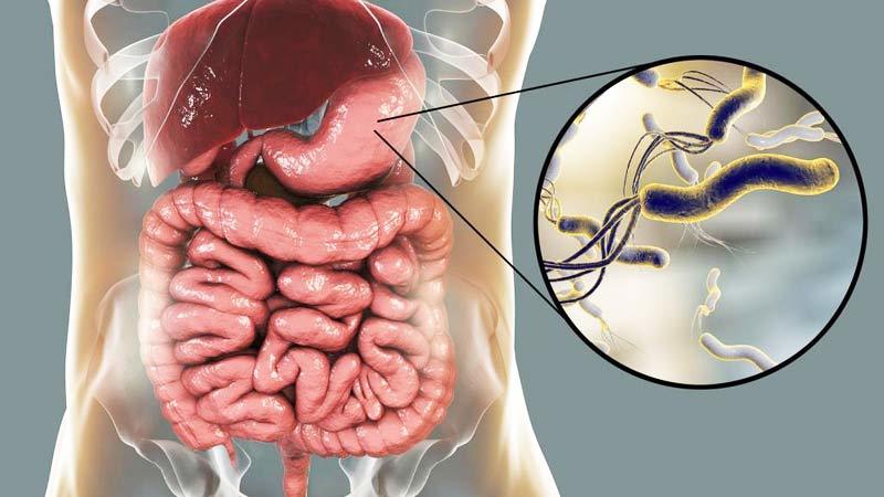 Хеликобактер пилори: бактерия, которой заражено 60% населения земного шара