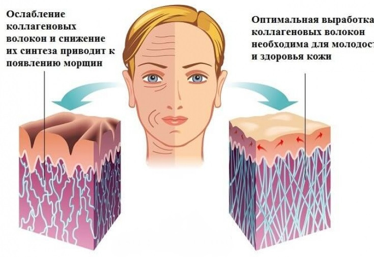 Гликация — причина раннего старения организма