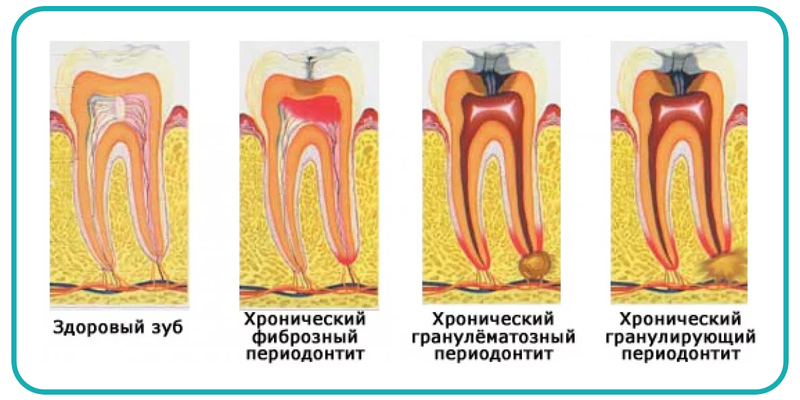 14 смертельно опасных привычек, которые вы можете считать безобидными