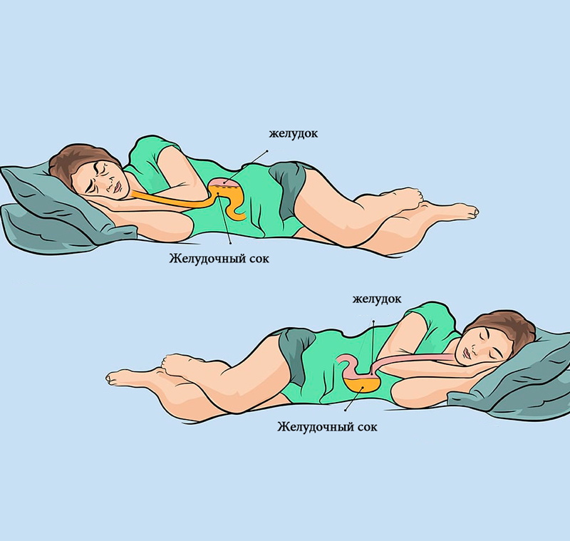 Почему нужно спать на левом боку: 7 причин