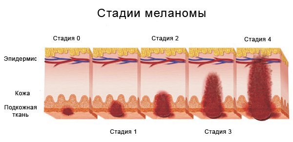 9 неочевидных вещей, которые увеличивают риск онкологии 