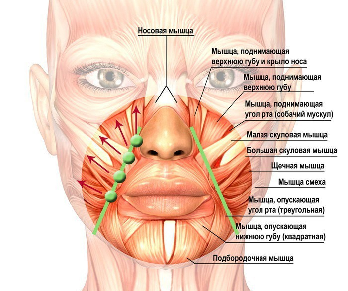 Супертехника для подтяжки лица и носогубных складок