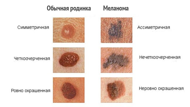 9 самых опасных и незаметных болезней