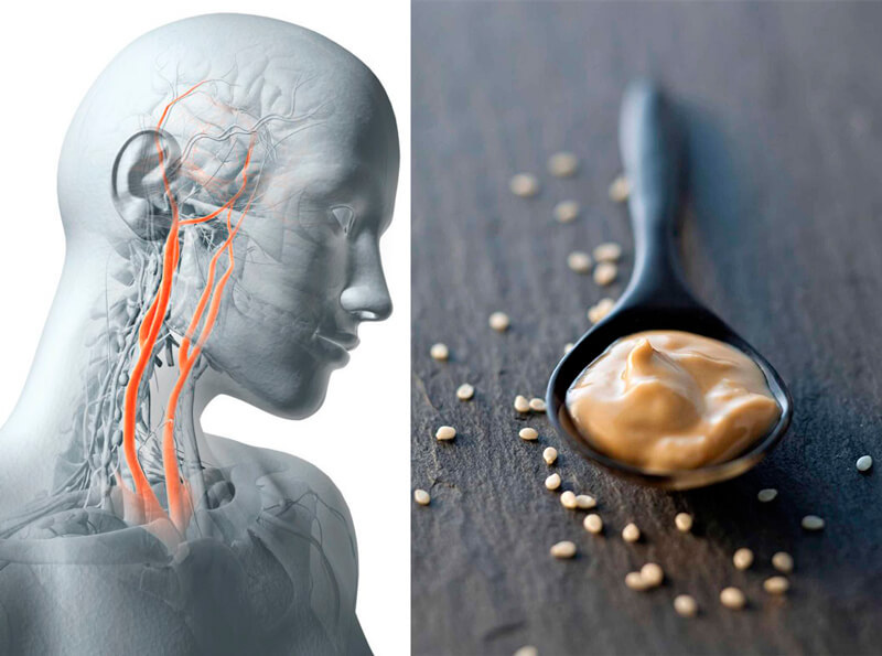 Рецепт целительной кунжутной пасты от гипертонии и высокого холестерина