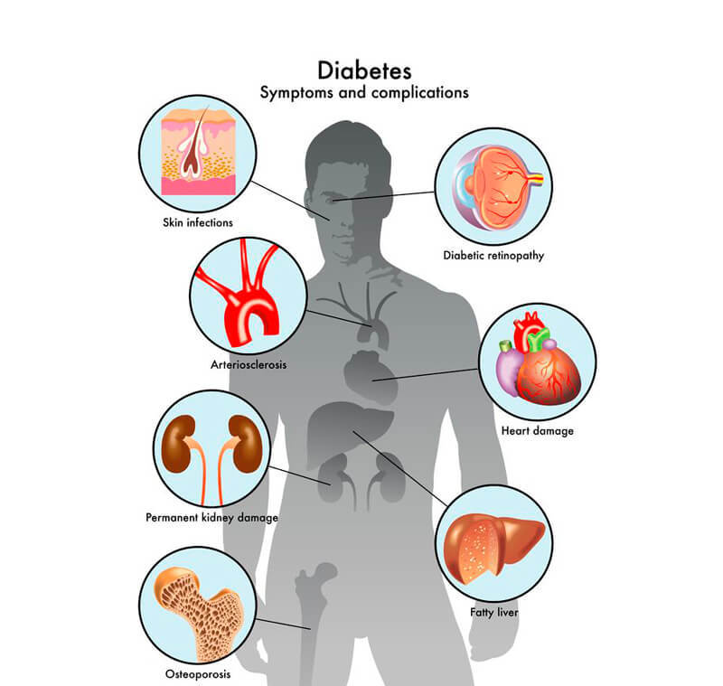 Сахарный диабет: первые симптомы