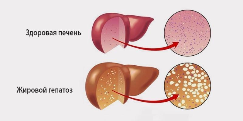 Ключ к здоровью печени