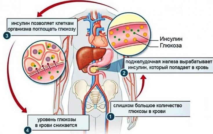 Как взять инсулин под контроль и запустить процесс сжигания жира?