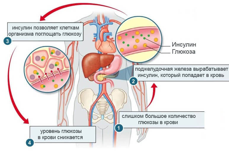 Как понять, что инсулин повышен