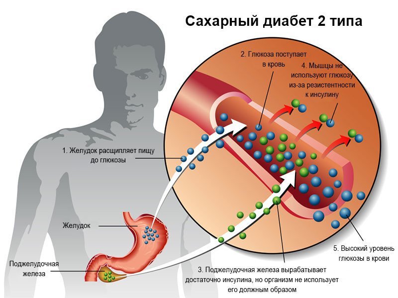 Гликемический индекс и гликемическая нагрузка