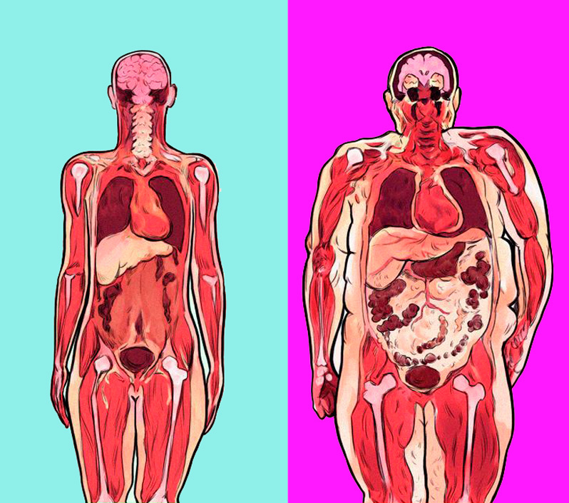 Почему висцеральный жир опасен и как от него избавиться