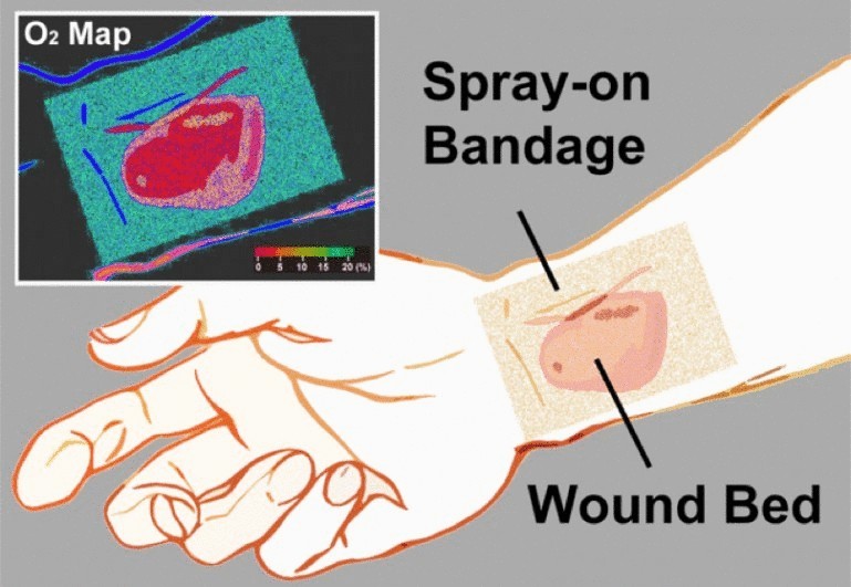 Медицинская повязка нового поколения способна рассказать о состоянии раны