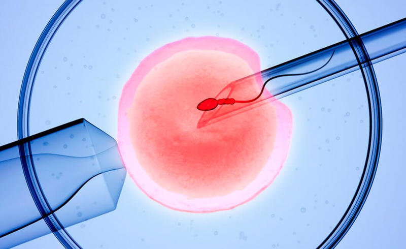 Последствия ЭКО для здоровья в будущем: мнение врача