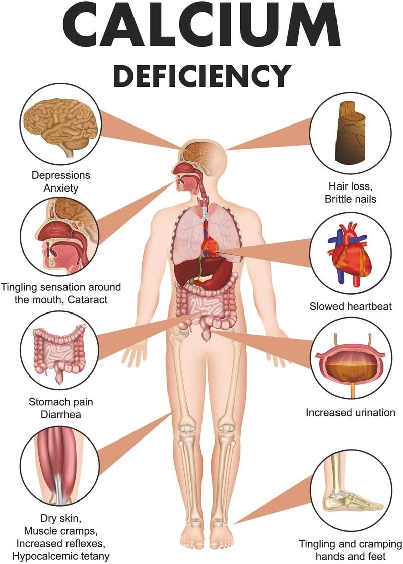 Признаки нехватки кальция в организме