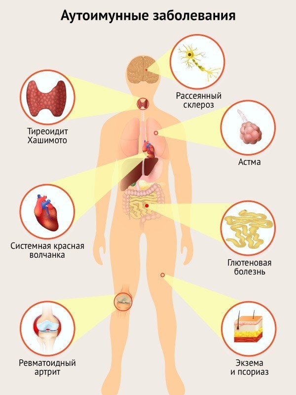 Лечение аутоиммунных заболеваний - натуральные средства, питательные вещества, витамины и диета 