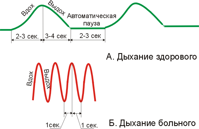 Оздоровительная техника дыхания по методу Бутейко