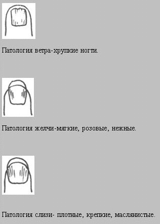 Восточная медицина: О каких болезнях можно узнать по ногтям