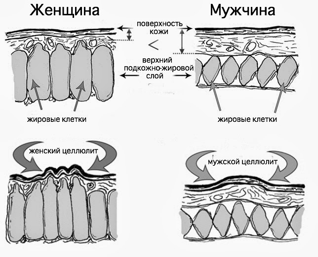 Как избавиться от целлюлита: что есть, на какие процедуры ходить и какие упражнения делать